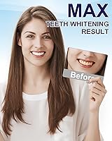 Vista 8 de MySmile Kit de blanqueamiento dental para dientes sensibles con luz LED, 3 piezas de gel blanqueador de dientes, 2 bolígrafos blanqueadores