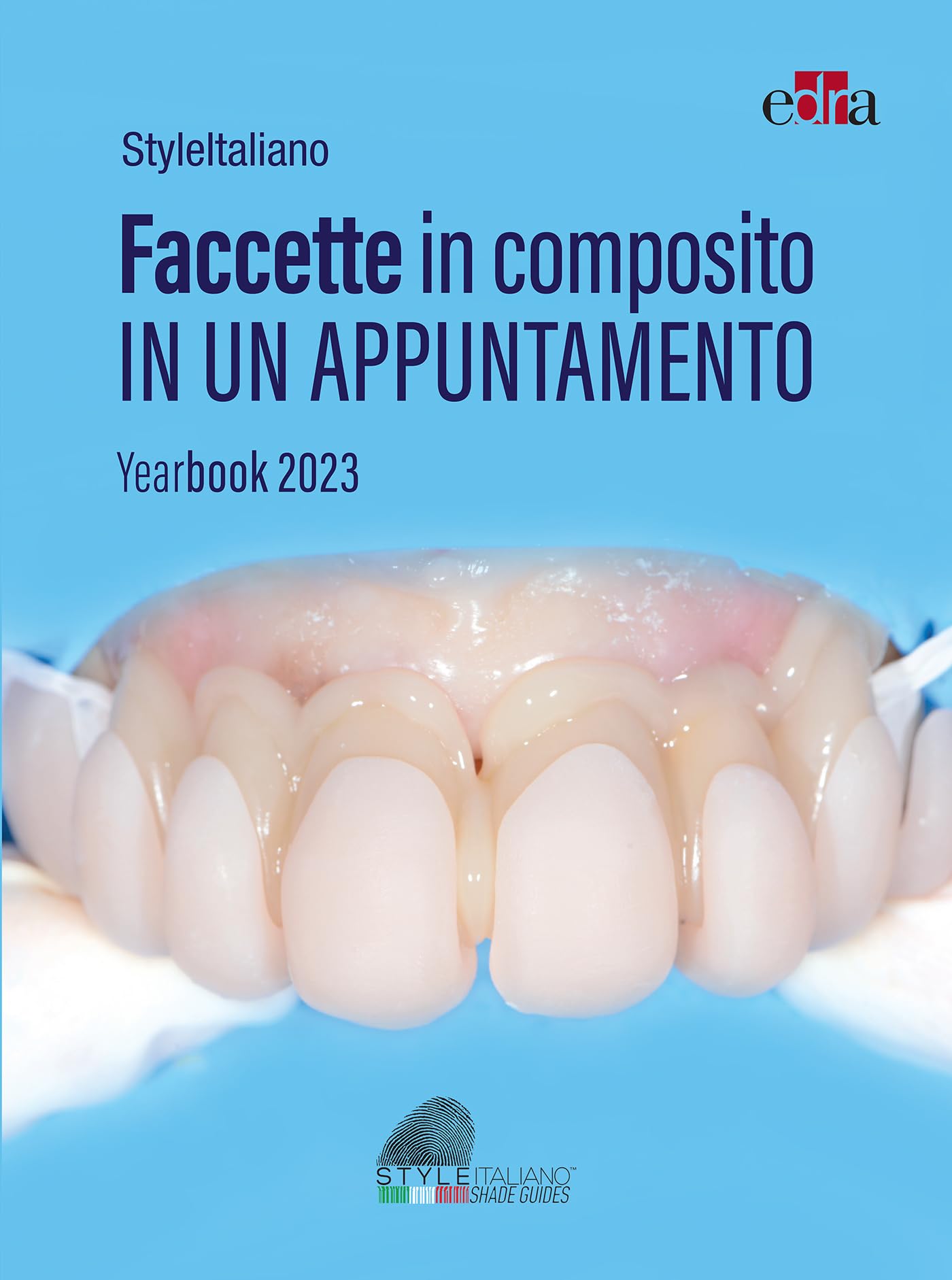 Faccette in composito in un appuntamento: Yearbook 2023