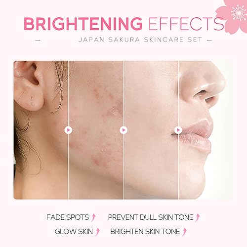 Miniatura 2 de Set de cuidado de la piel - Conjuntos de regalo para mujer - Sakura Skin Care Sets & Kits - Set de regalo con limpiador, tóner, suero, crema para