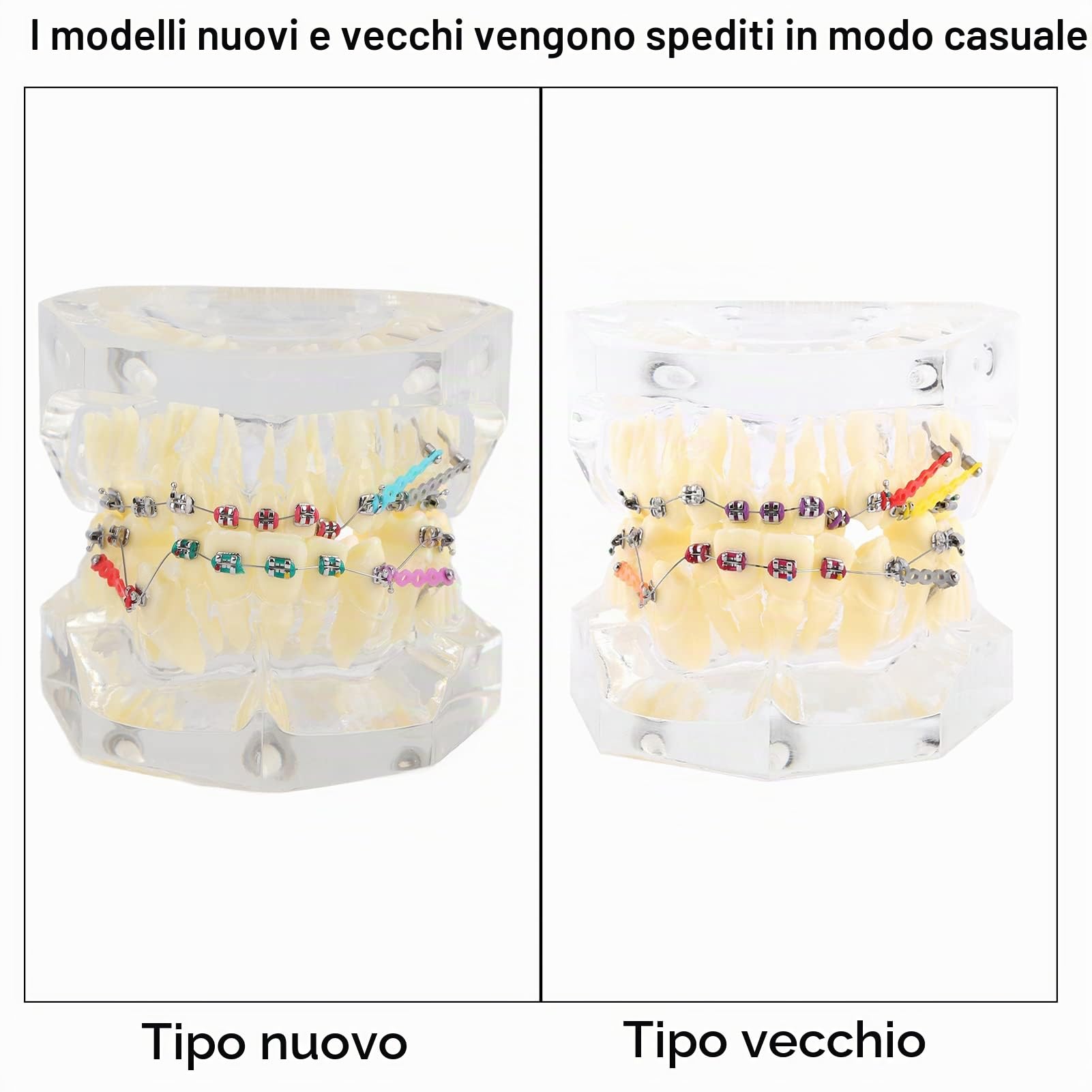 Staffe Ortodontiche, Modello di Denti Trattamento Ortodontico Dentale Studio di Malocclusione Modello di Denti con Staffe Dentali a Catena Metallica