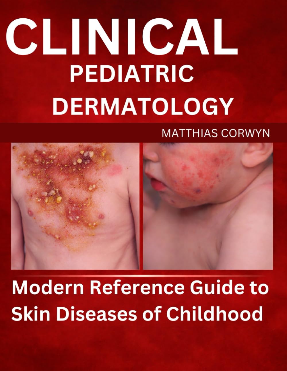 CLINICAL PEDIATRIC DERMATOLOGY: Modern Reference Guide to Skin Diseases of Childhood