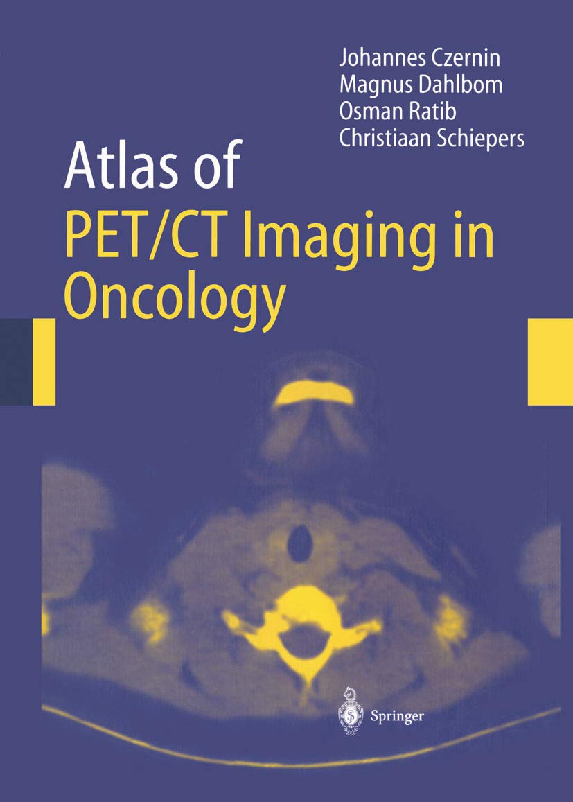 Atlas of PET/CT Imaging in Oncology (English Edition)