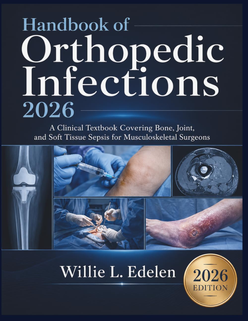 Handbook of Orthopedic Infections 2026: A Clinical Textbook Covering Bone, Joint, and Soft Tissue Sepsis for Musculoskeletal Surgeons