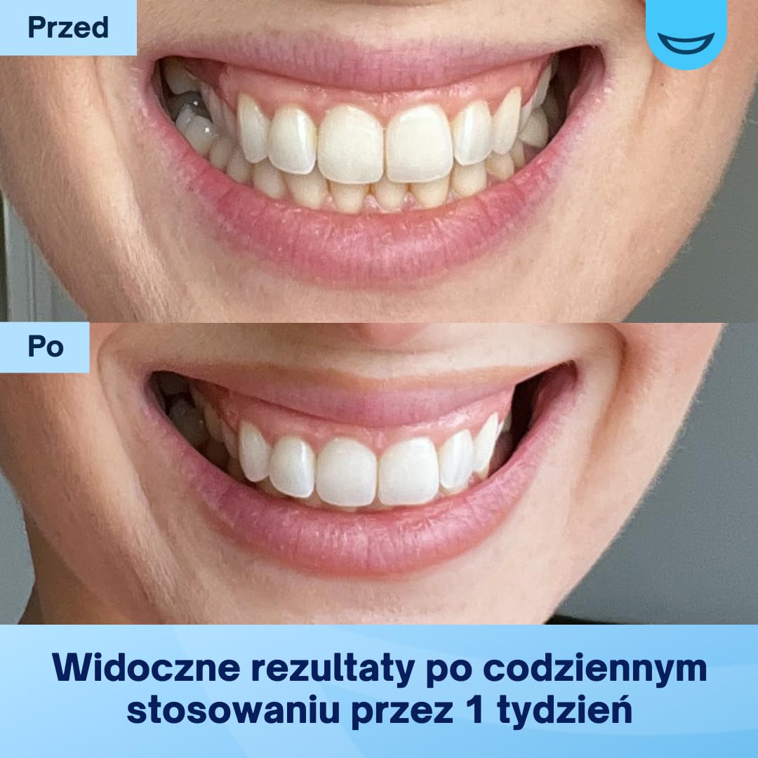 MySweetSmile Paski Wybielające Zęby PAP - Bezpieczne Dla Szkliwa, Bez Nadwrażliwości - Bez Peroksydu - Zatwierdzone Przez Dentystów - Nagroda IndyBest - 21 Zabiegów - Miętowy Smak