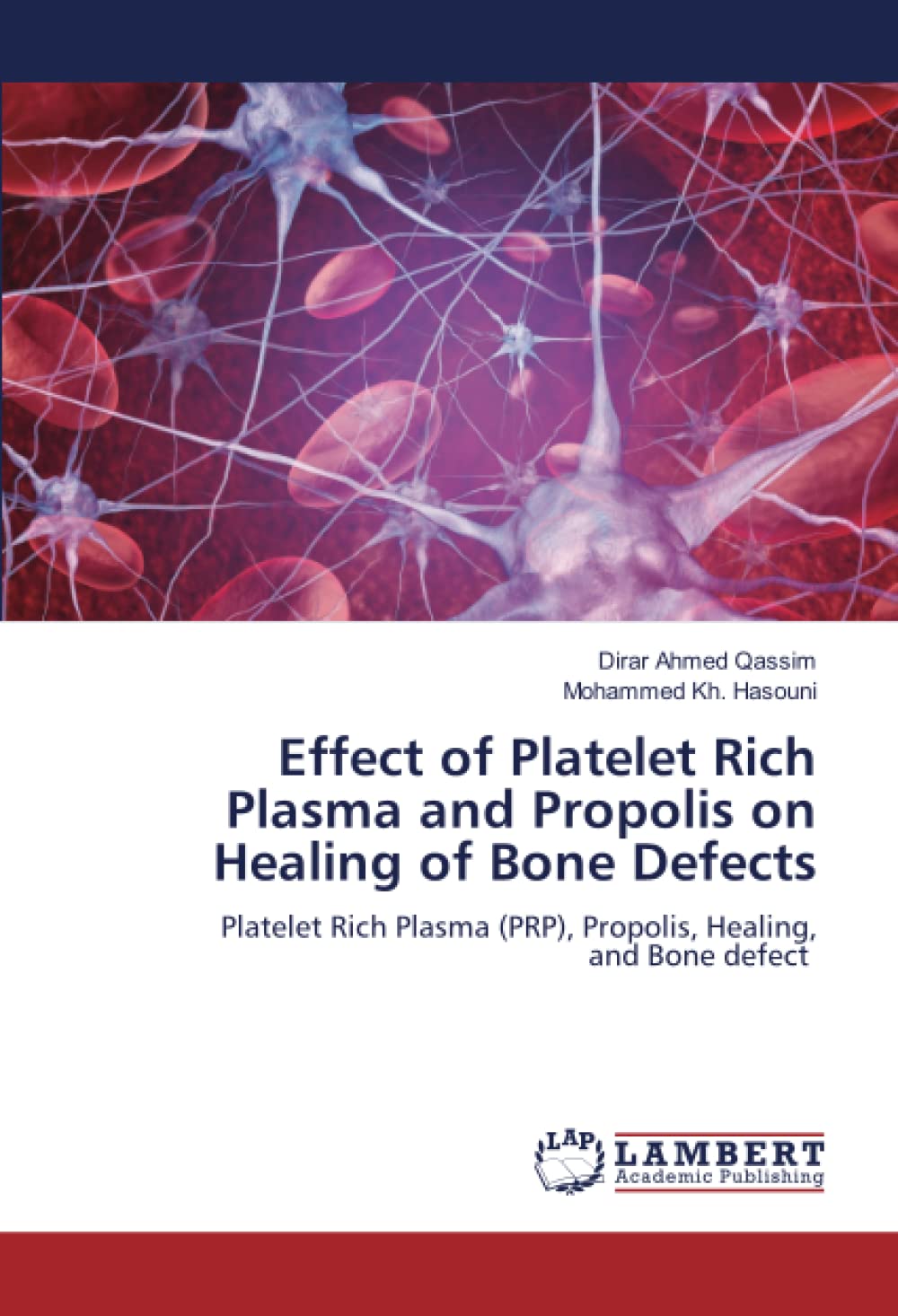 Effect of Platelet Rich Plasma and Propolis on Healing of Bone Defects