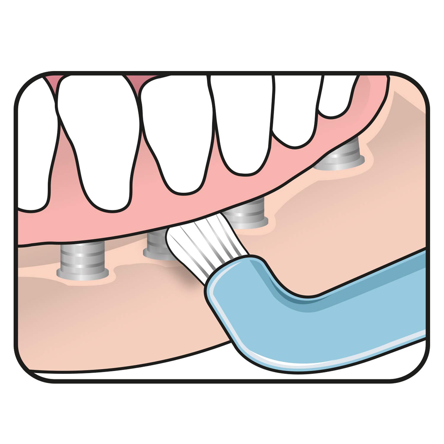 TEPE Compact Tuft Spazzolino da denti con testina rotonda per una pulizia accurata della bocca anche in impianti o protesi colorati Assortiti