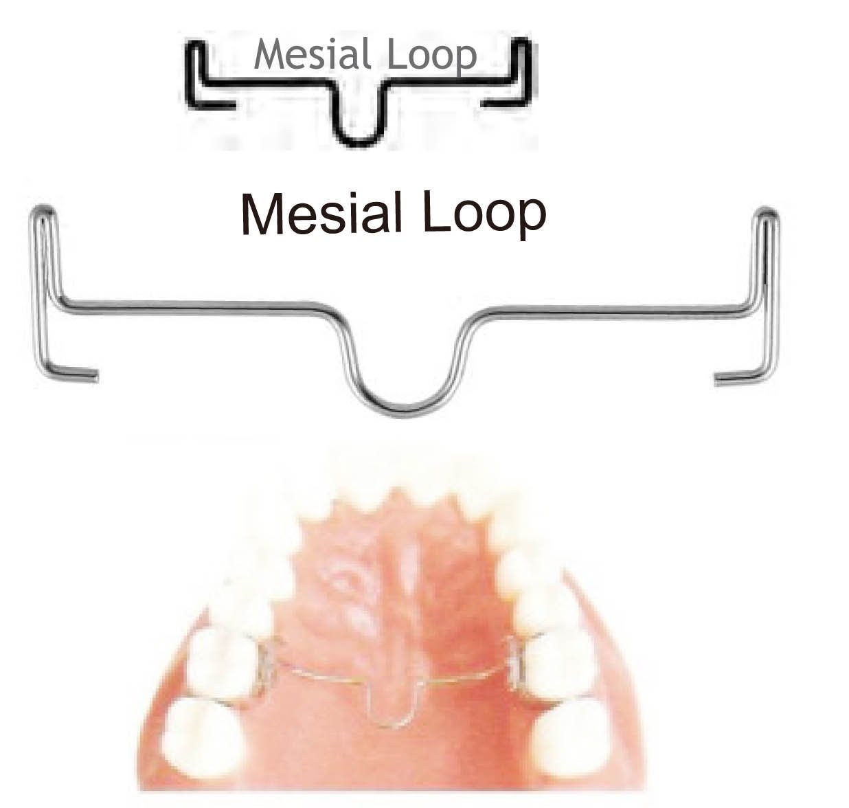 2 Pack (20) SmileTech Palatal Arch Bar Distal Loop Dental Orthodontics Ten Assorted Sizes