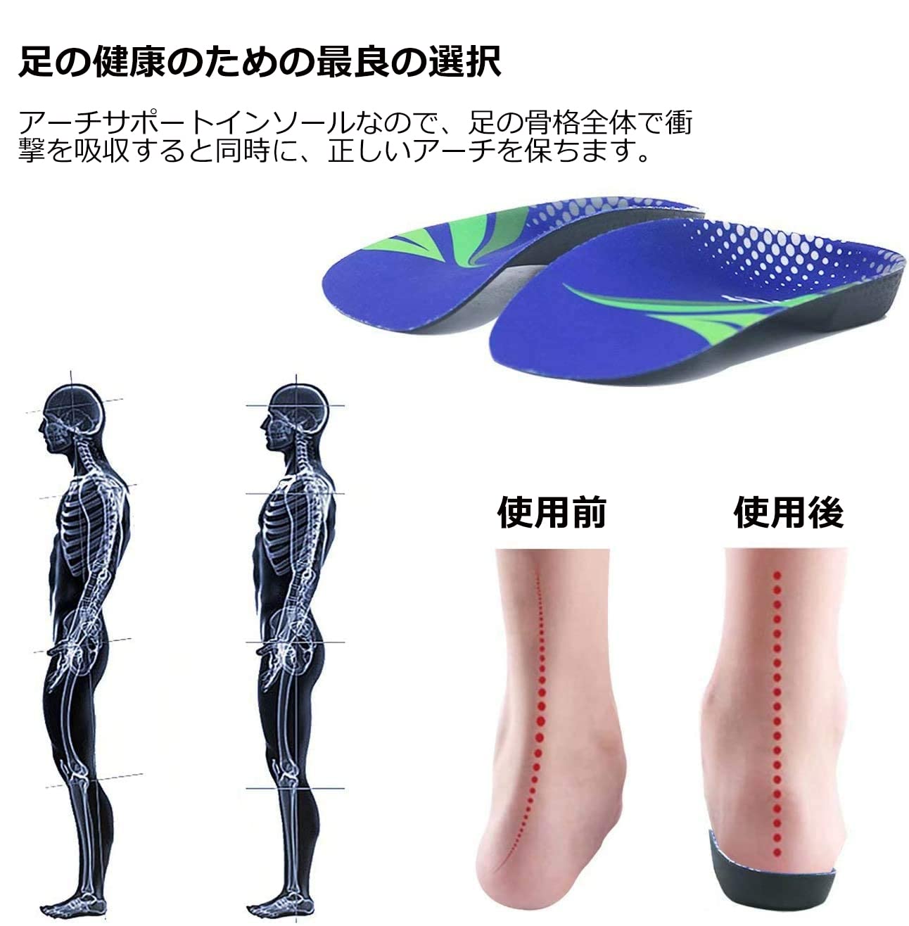 Amazon.co.jp: FitFeet 扁平足 インソール 中敷き 衝撃吸収長さ3/4半敷
