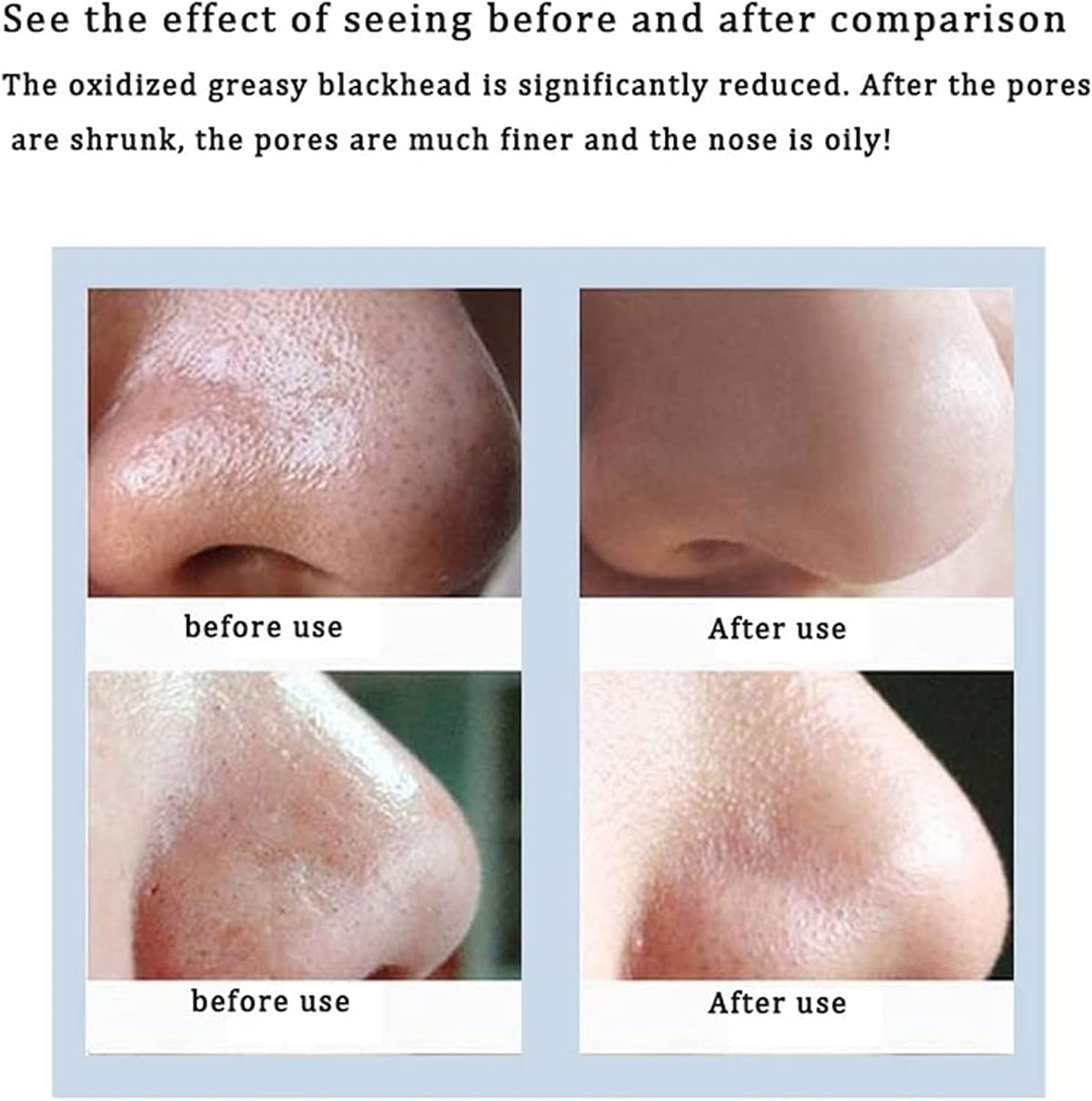 Removedor de Puntos Negros, Herramienta extractora de Puntos Negros, Limpiador Facial con 4 potencias de succión Ajustables y 3 sondas de succión, máquina limpiadora de Puntos Negros