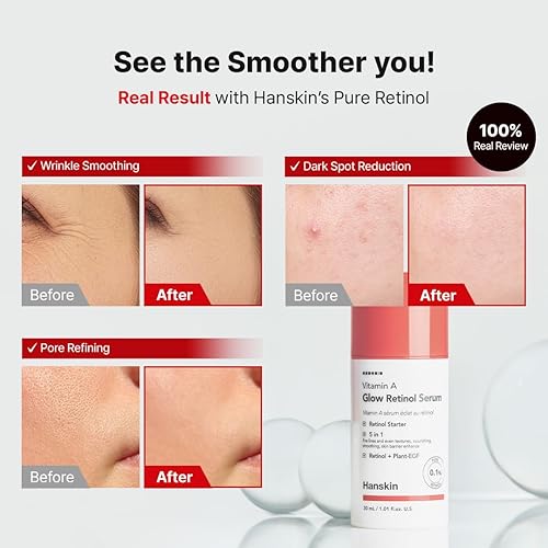 Miniatura 3 de Hanskin Suero facial de retinol puro 0.1% para cara, reduce las líneas finas y arrugas, signos de envejecimiento para el día y la noche, suavizante
