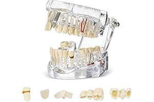 Outus Odontologia Insumos Dental Typodonts