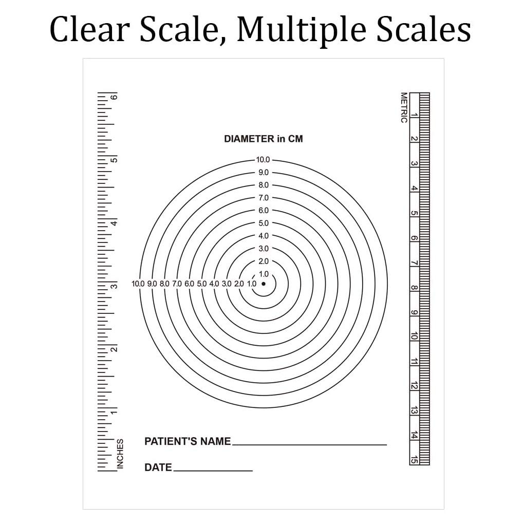 Righello Per Misurazione Ferite 18 Cm - Carta Monouso, Confezione Da 100 Pezzi, Per Documentazione Medica - Foto 3
