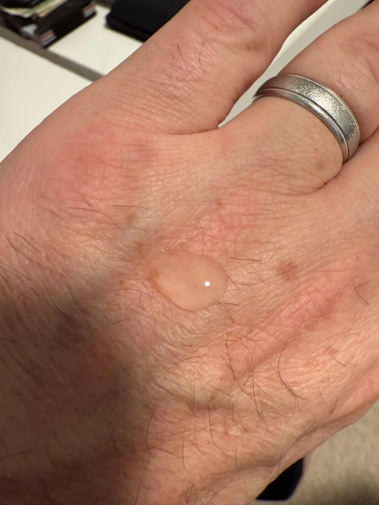 Dermaganika Derma ganika Retinol & Vitamin E Serum for Face - Made in USA Collagen-Boosting Anti-Aging Serum | Reduces Fine Lines, Wrinkles & Hyperpigmentation | Smooths & Hydrates Skin (Pack of 2)