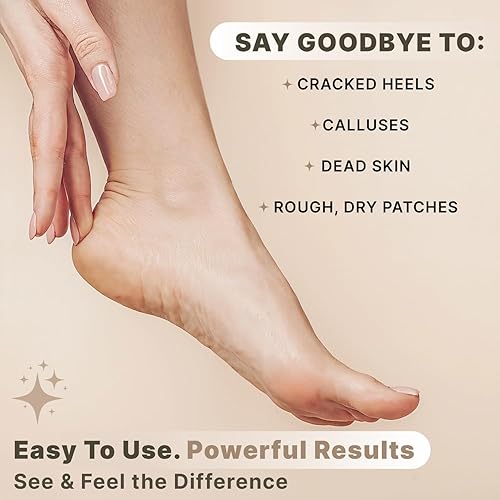 Miniatura 3 de Exfoliante de lava piedra pómez naturales Removal para manos & Rough pies secos Plus, Dead, o duro agrietada Heels mejor para pedicura Callos a &