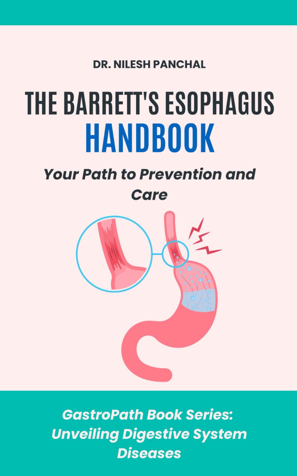 The Barrett's Esophagus Handbook: Your Path to Prevention and Care (GastroPath: Unveiling Digestive System Diseases)