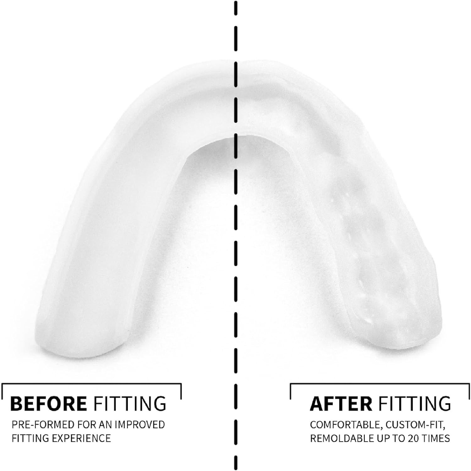 SOVA 3D Night Guard with Case - Pre-Formed, Easy-to-Fit Protection for Teeth Grinding, Clenching - Jaw Pain, Bruxism, TMJ Relief - Taste Free - Remoldable Up to 20 Times - Non Toxic