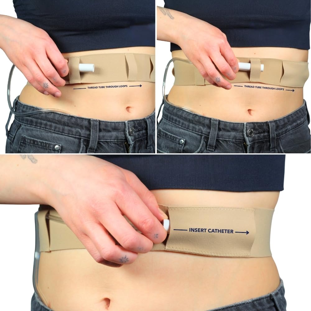 Cintura per tubo per dialisi peritoneale, sottile, morbida ed elastica, sicura per la pelle, prodotta nel Regno Unito, accessori medici per dialisi peritoneale.