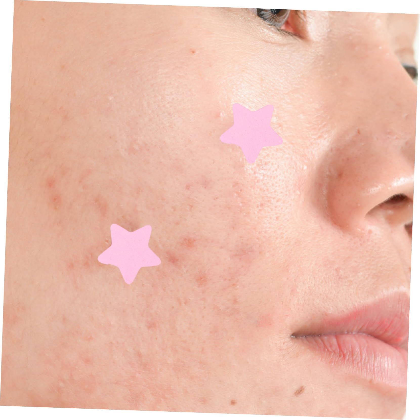 Parches Para Acné Hidrocoloides Coloridos Para Espinillas De Parches Invisibles Para Cuidado Facial Material Y Efecto Hidratante 4 Hojas X 5