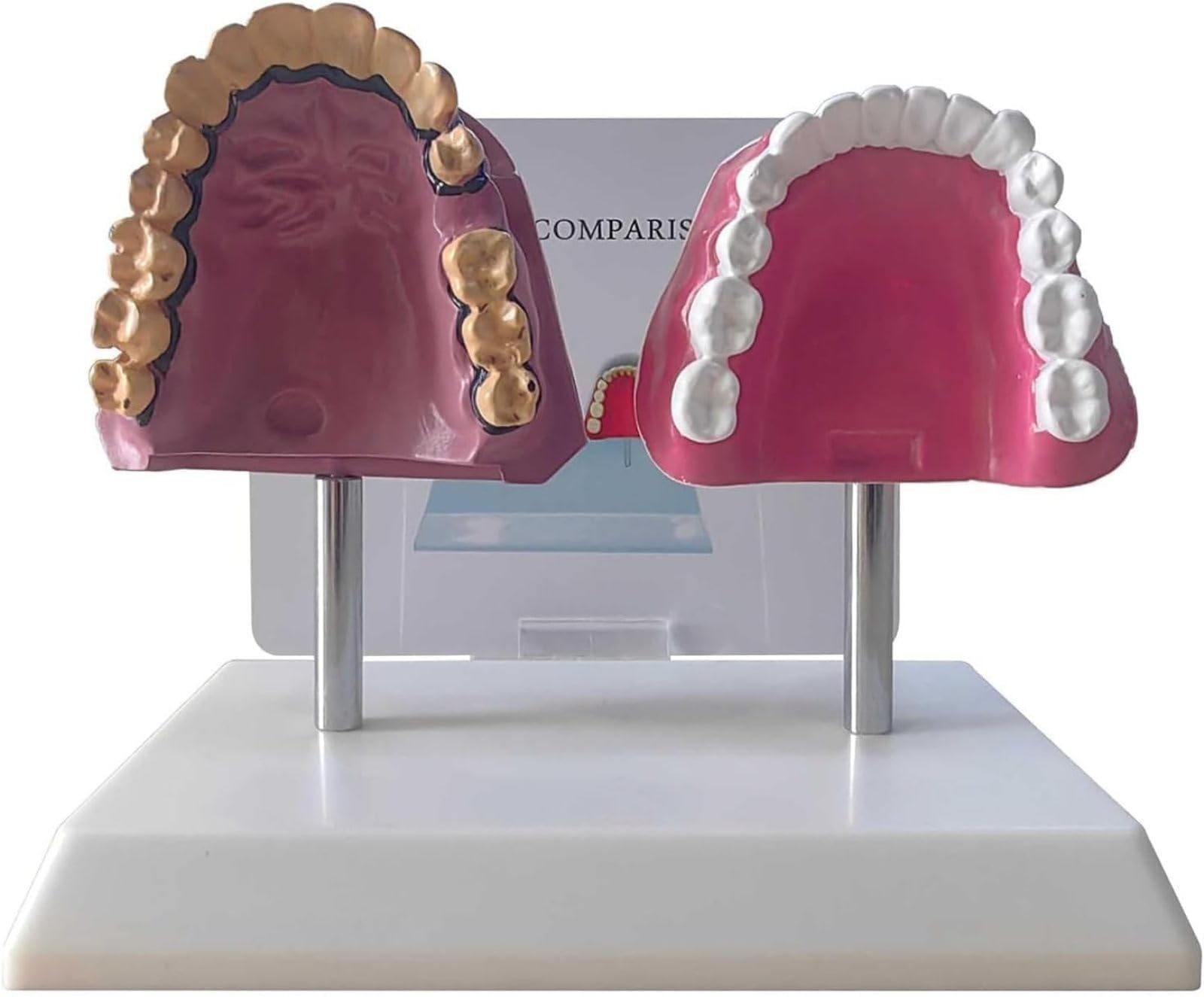 Modello Anatomico dei Denti del Orale Umano, Struttura Anatomica Accurata E Patologica, per Studenti di Odontoiatria