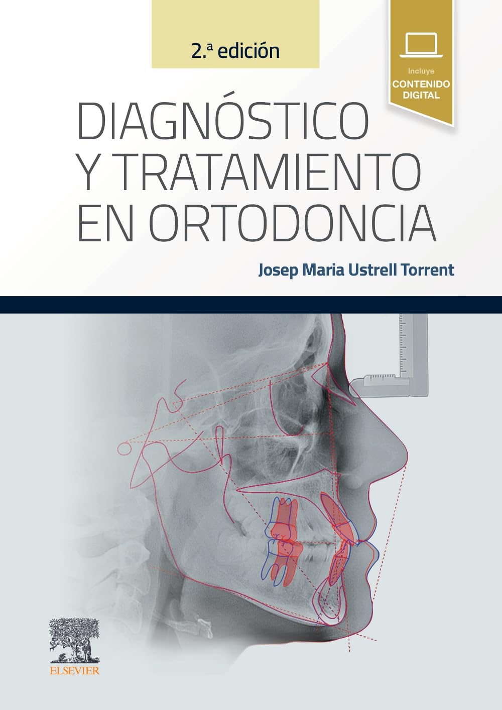 Diagnóstico y tratamiento en ortodoncia