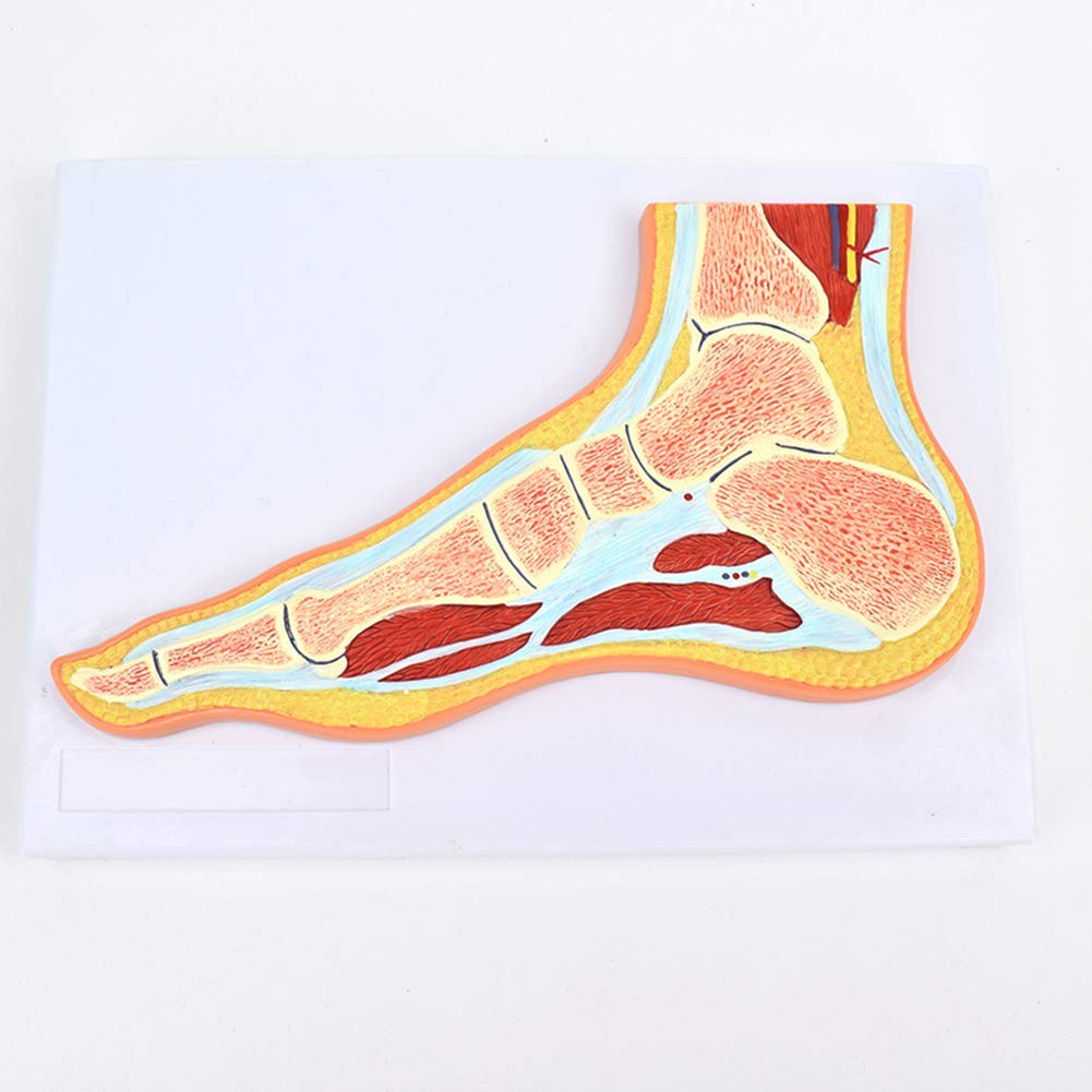 Sjdopulse Humanfoot Joint Model, Ankle Joint Skeletal Muscle Anatomy Model, 1: 1 Equal Scale For Medical Research Display Teaching Training-Mri Orthopedics Teaching