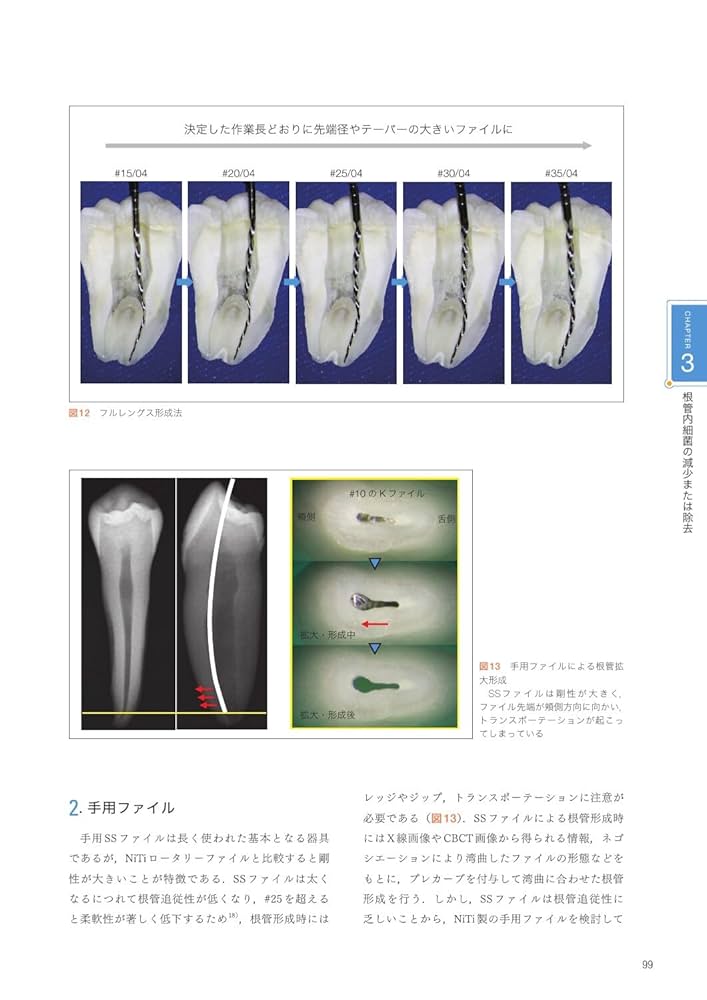 根管治療のクリニカルメソッド 根管治療のクリニカルメソッド／医歯薬出版株式会社