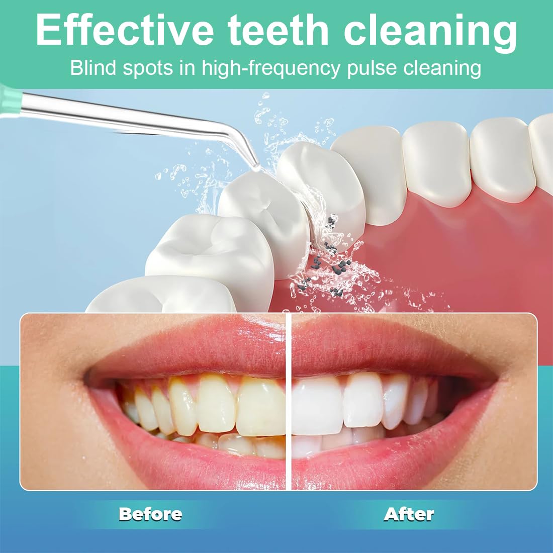8 pezzi Ricambio Punte Spruzzo Dentario Acqua Idropulsore Ugello Accessori per Waterpik idropulsore dentale e Altri Irrigatori Orali