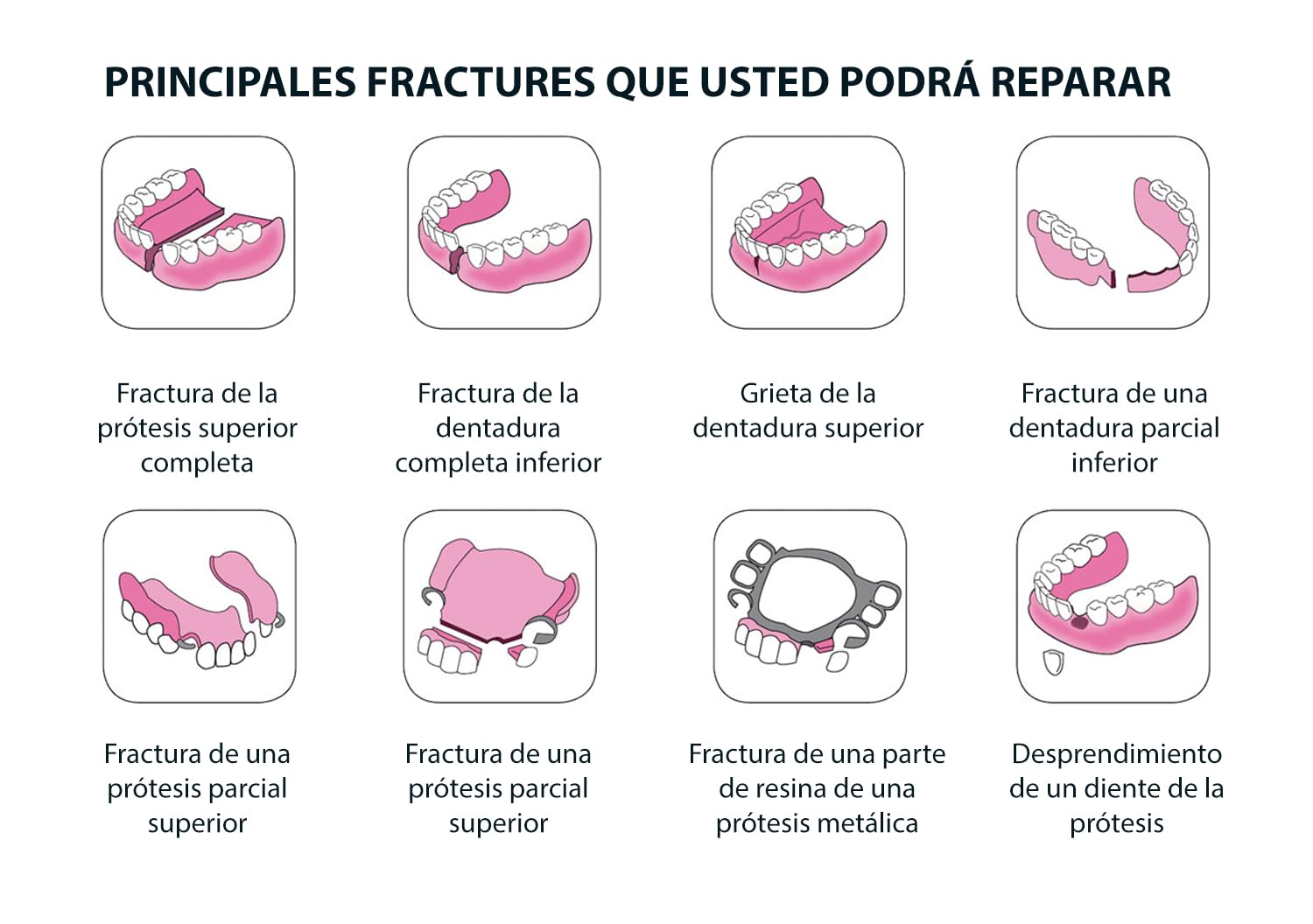 CLICADENT REPAIR- Kit de reparacion para una dentura postiza o un diente suelto