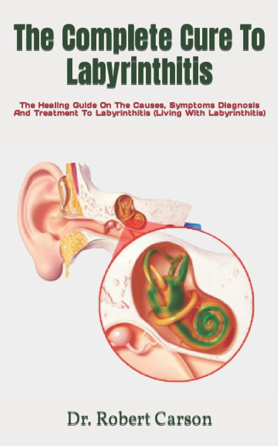 The Complete Cure To Labyrinthitis The Healing Guide On The Causes