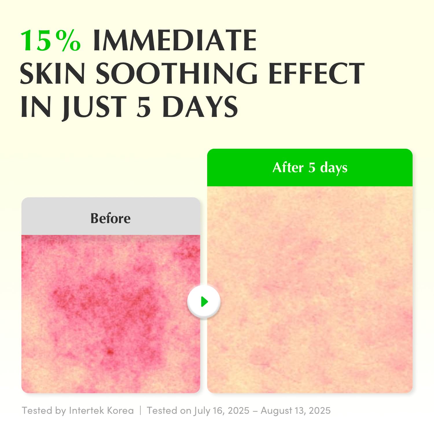 Aloe PDRN Calming Serum – Hassas ve Akneye Eğilimli Ciltler için Yatıştırıcı ve Onarıcı