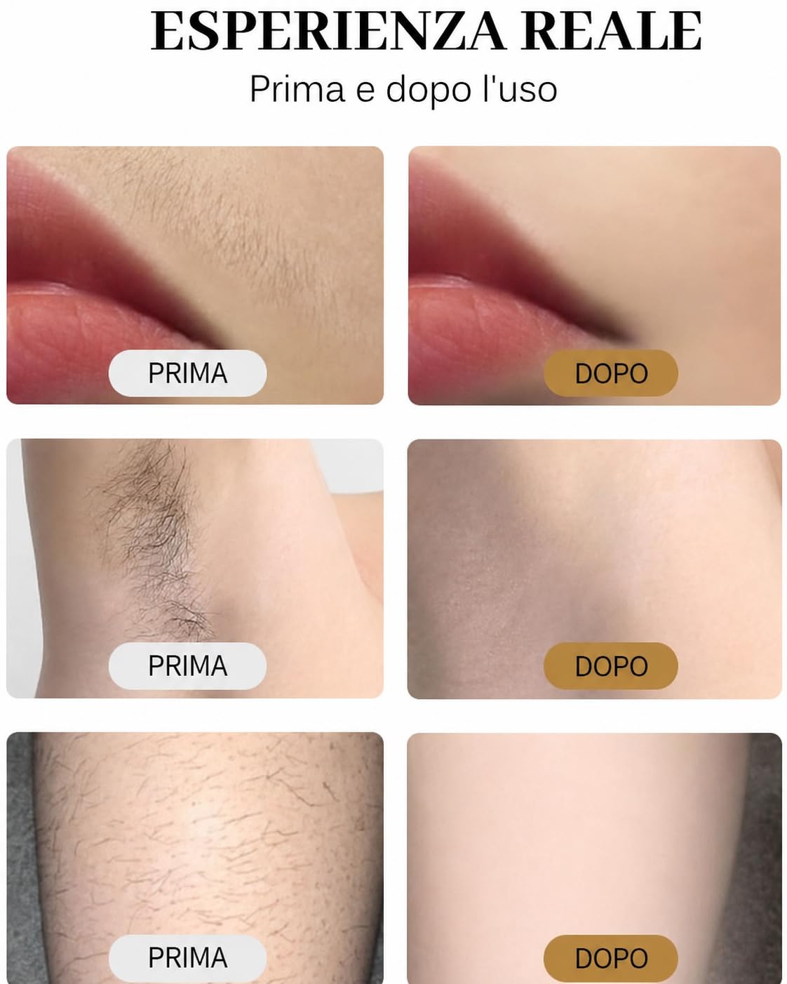 Epilatore Laser a Diodi 808 nm Professionale, Dispositivo per Depilazione con 10 Barre Laser, Lunghezze d’Onda 755/808/1064 nm, Raffreddamento al Platino, Display Touch HD, per Salone