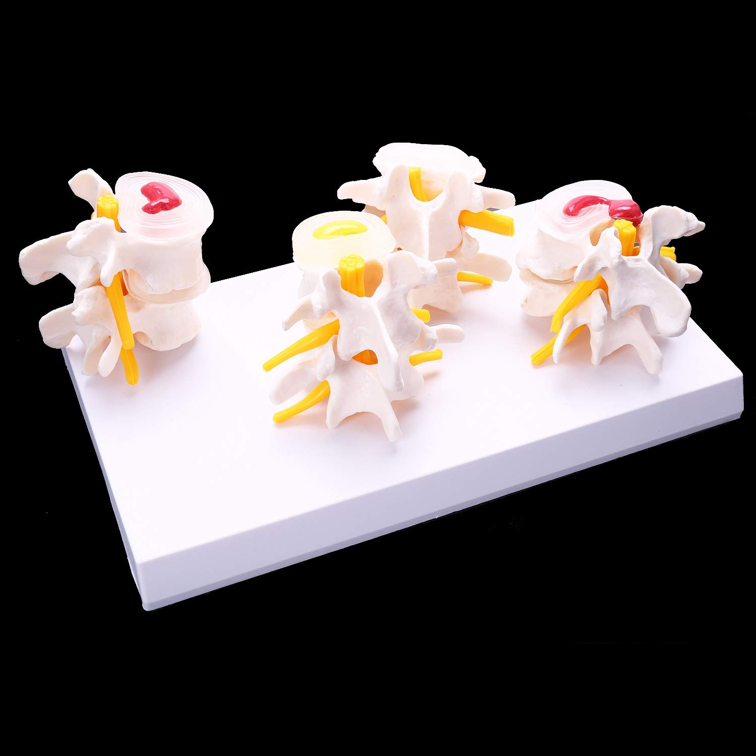 Modele anatomiczne Anatomia człowieka Szkielet Kręgosłup 4-etapowy Model Kręgów Lędźwiowych Mózg Czaszka Uraz Do Medycznych Materiałów Dydaktycznych Medyczne Narzędzie Dydaktyczne