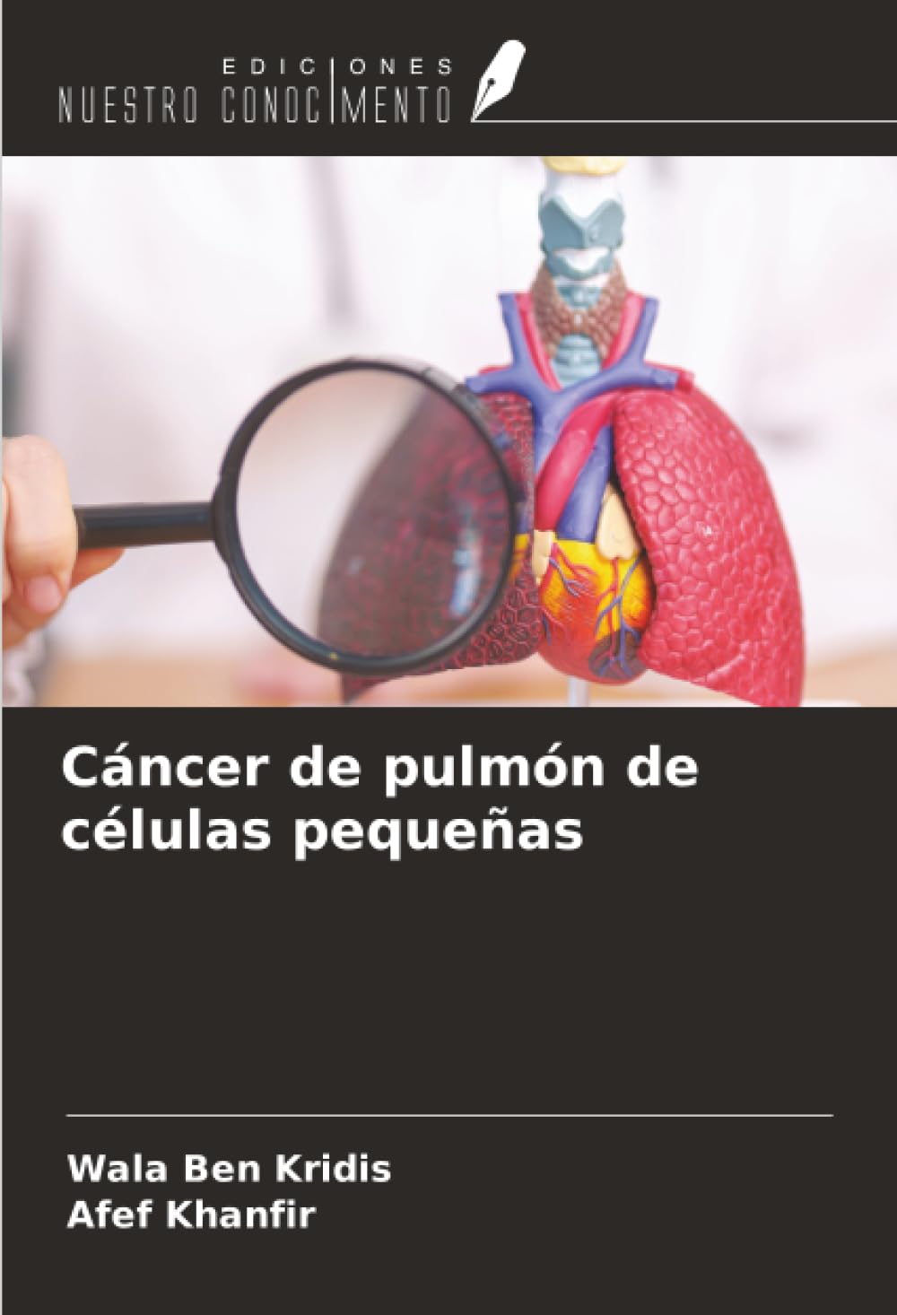 Cáncer de pulmón de células pequeñas