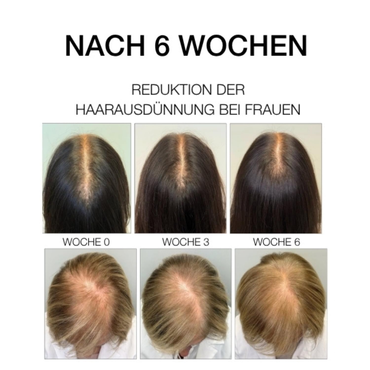 DIEGO DALLA PALMA MILANO - ESTREMIRIMEDI Serum 6 Kräftigende Pflege für Kopfhaut und Haar. Stimuliert die Mikrozirkulation. Stärkt die Haarfaser. 50ml