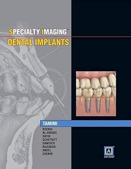 Specialty Imaging: Dental Implants