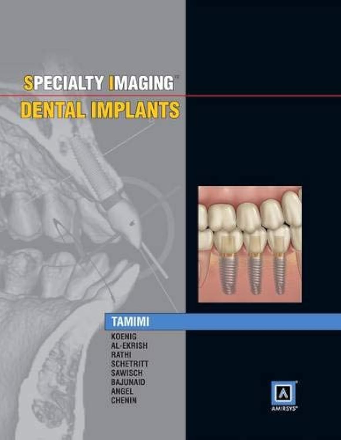 Specialty Imaging: Dental Implants Hardcover – Big Book, 17 September 2014