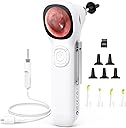 ScopeAround Digital Otoscope w/Built-in Screen, Manual-Focus Digital Otoscope with Light for Home Use, No App Needed, Easy Viewing for Everyday Ear Checks, Otoscope Camera, White