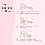 grace & stella Award Winning Hydrocolloid Skin Rescue Covers with Mirror Case - With Salicylic Acid and Tea Tree for Absorbing Impurities - Dermatologist Tested Vegan Skin Care (Multishape, 72 Pack)