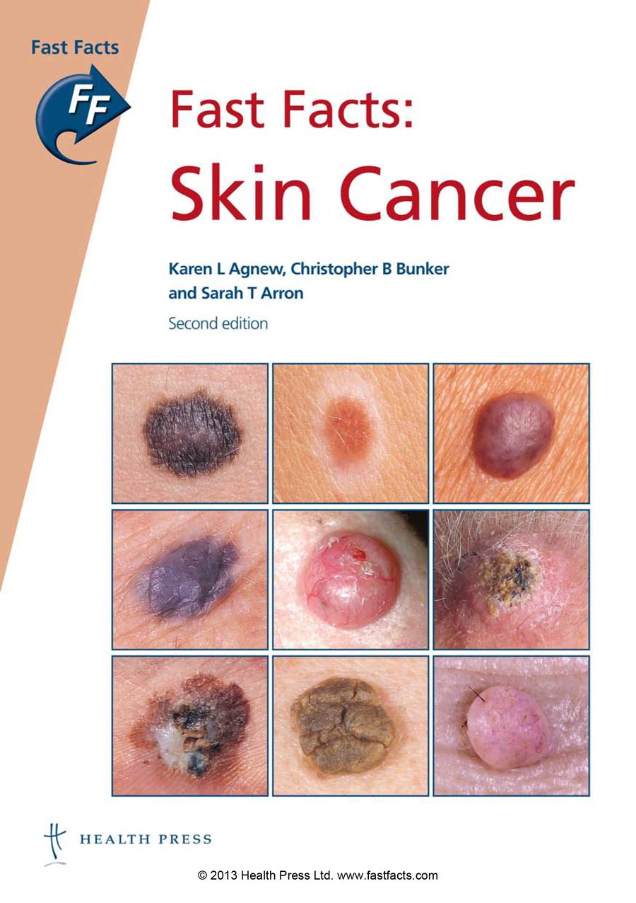 Buy Fast Facts: Skin Cancer — BookShops.in