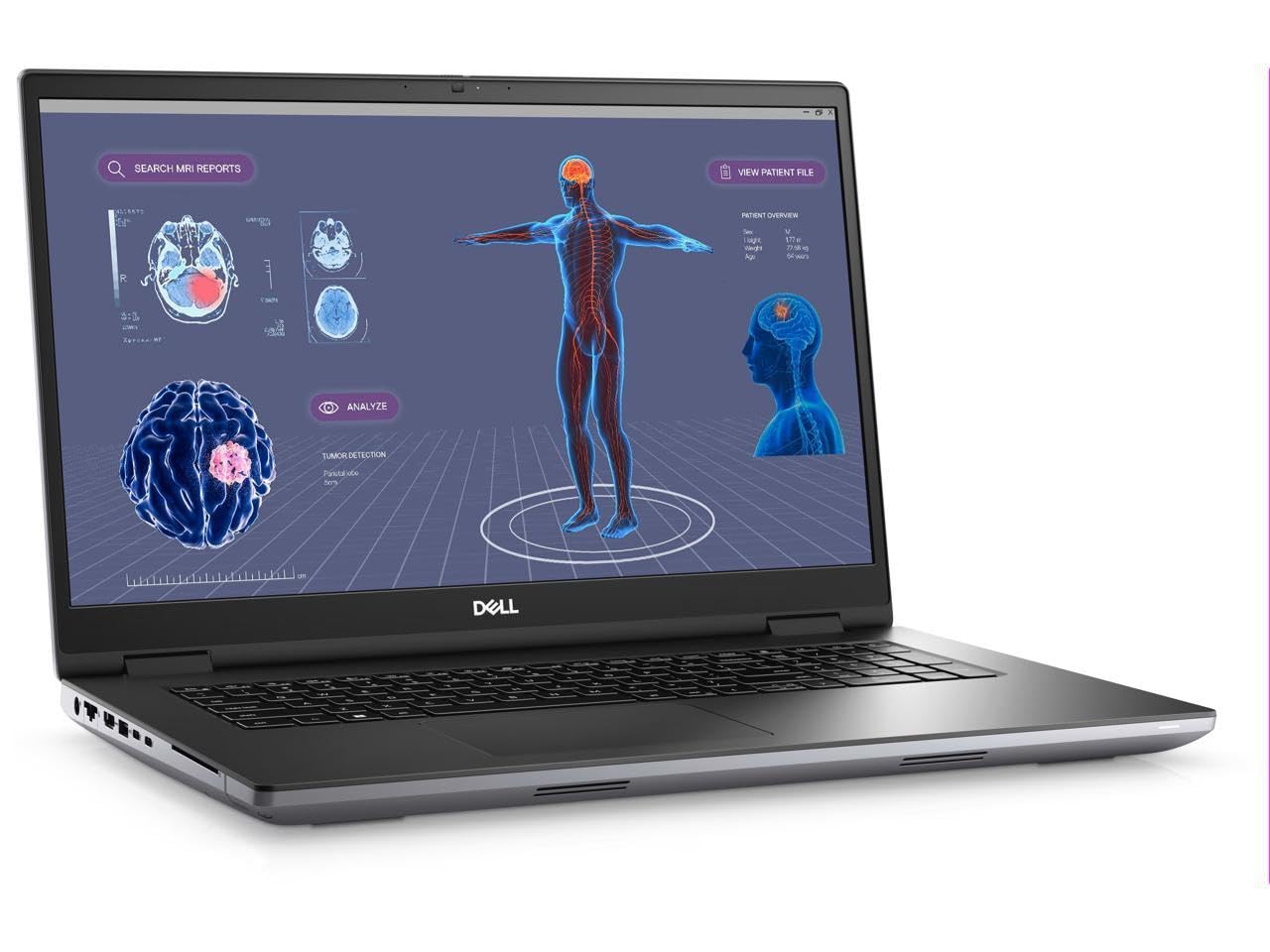 Amazon.com: Dell Precision 7000 7780 17.3