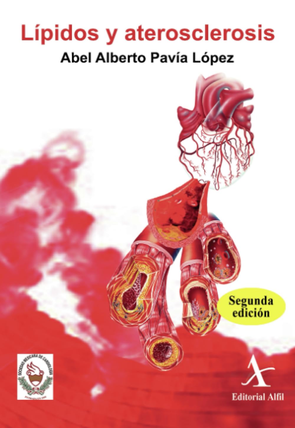 Lípidos y aterosclerosis, 2da. Edición.