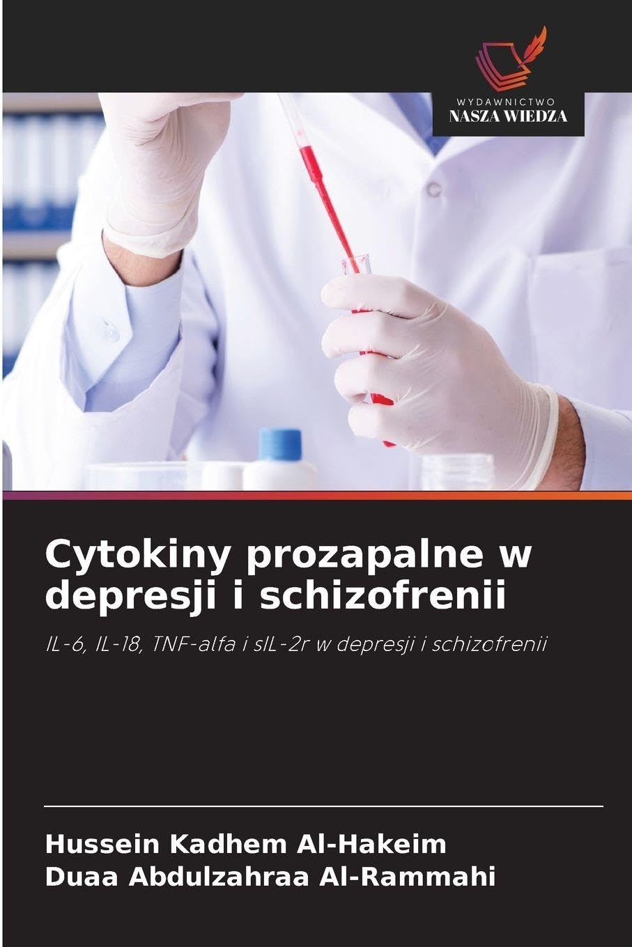 Cytokiny prozapalne w depresji i schizofrenii: IL-6, IL-18, TNF-alfa i sIL-2r w depresji i schizofrenii