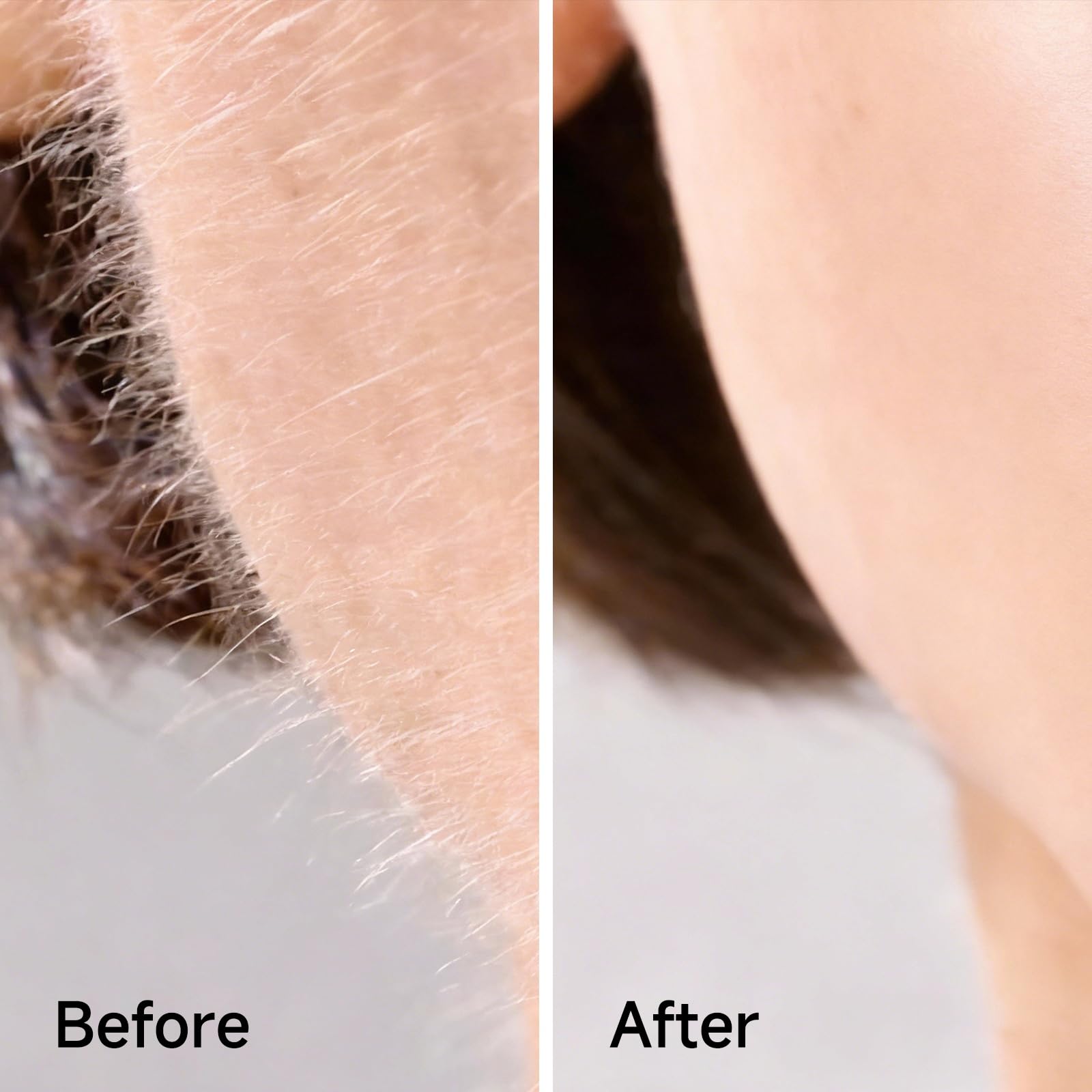 Sonic Dermaplane - Recambios de cuchillas Dermaplaning, 10 cuchillas de dermaplaning, suministro de 2 meses, dispositivo no incluido