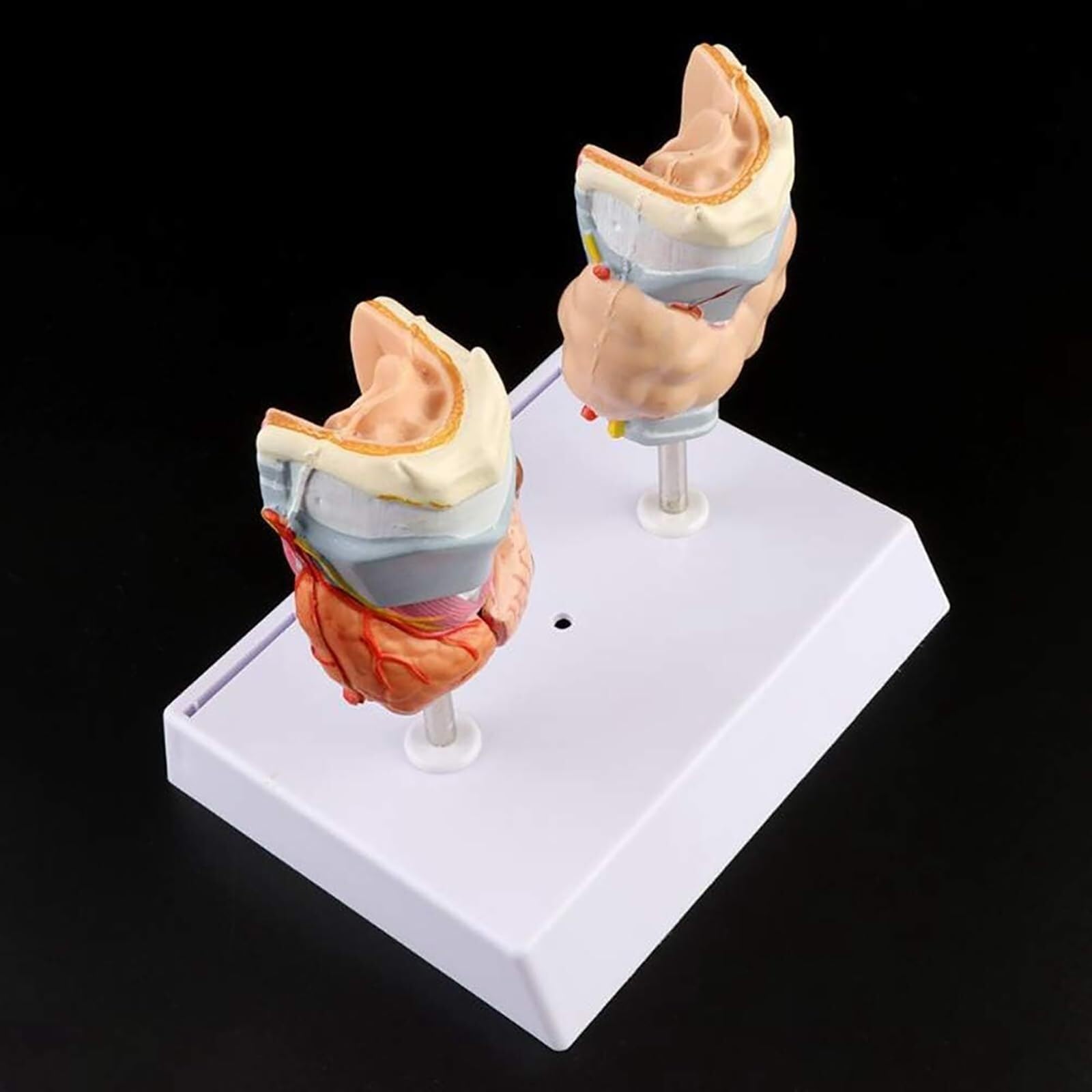 model anatomiczny, Model torbieli guza gardła tarczycy