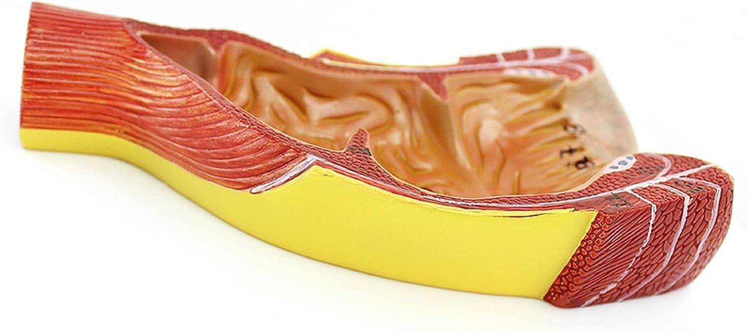 Modèle Anatomique du Rectum et de l'anus Humains, Anatomie Humaine Scientifique, Outils et Aides à la Formation des chirurgiens généraux en Chirurgie anorectale