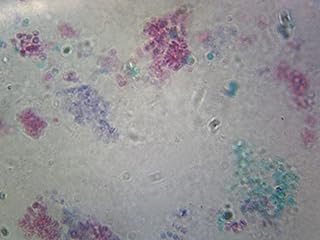 Saccharomyces Cerevisiae - Microscope Slide