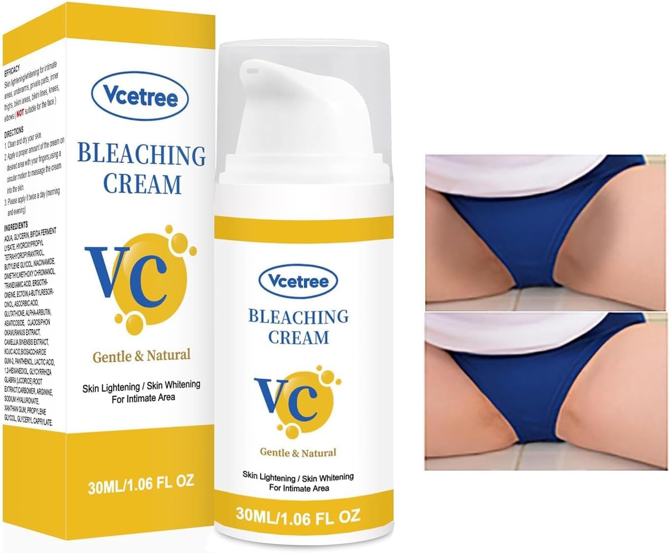Skin Bleaching Cream Skin Lightening for Body Intimate Areas, Private Parts, Underarm, Knees, Elbows, Inner Thigh, Bikini Area, Whitening Cream Dark Spot Remover For Intimate Areas (1FL OZ)