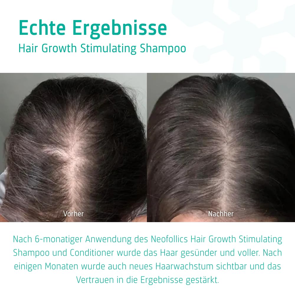 Neofollics - Haarwuchs stimulierendes Shampoo - Haarwuchsmoleküle + 7 Pflanzenextrakte und Arganöl - frei von Parabenen, Sulfaten und Silikonen