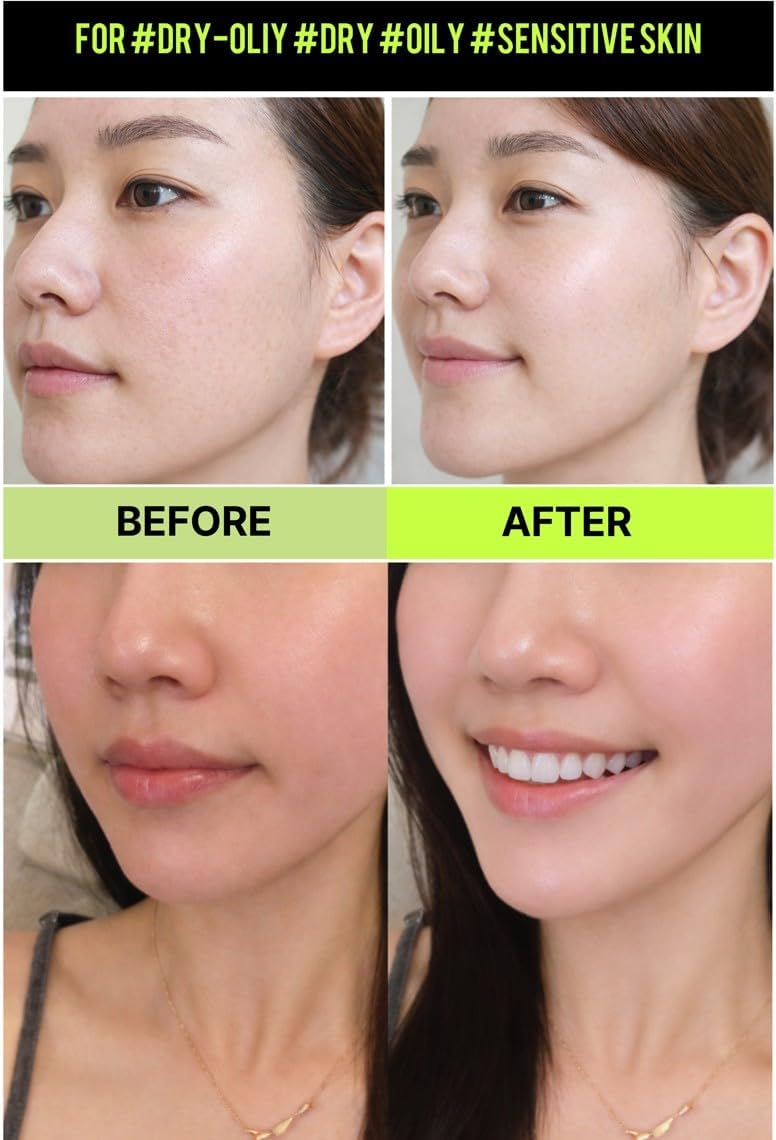 Houttuynia Cordata Revital Energy Toner/pH 5.5 Trouble Care, Calming Skin, Refreshing, Hydrating, Purifying, Vegan, Korean Skin Care (300ml / 10.14 fl oz) - Image 5