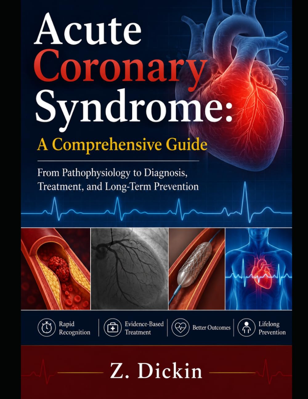 Acute Coronary Syndrome: A Comprehensive Guide